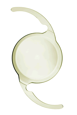 テクニスピュアシー（PureSee IOL）